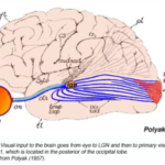 cerebralno oštećenje vida