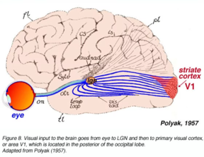 cerebralno oštećenje vida